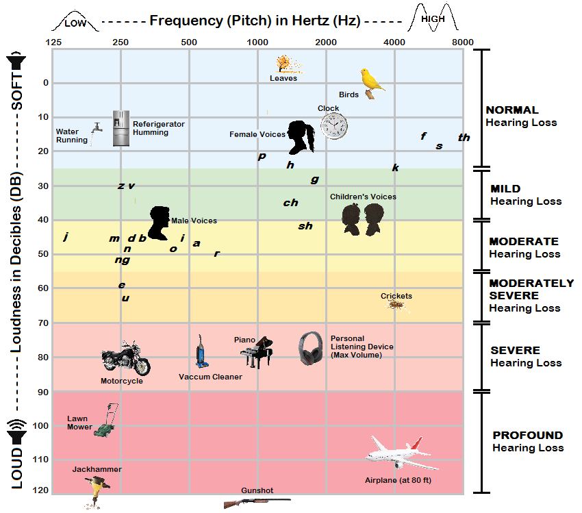 Audiogram